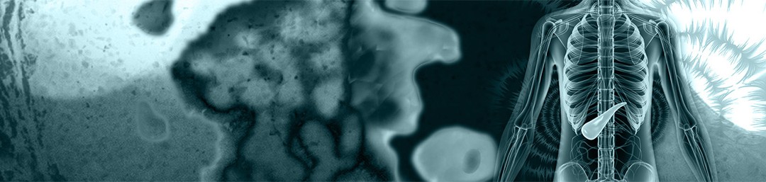 La Mécanobiologie du Cancer du Pancréas