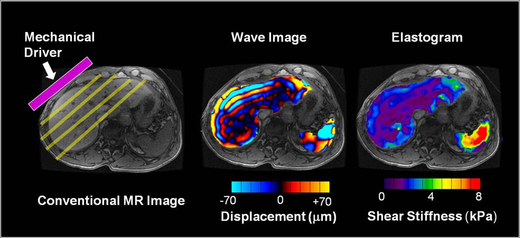 FORCE, Imaging the Force of Cancer : un programme européen H2020